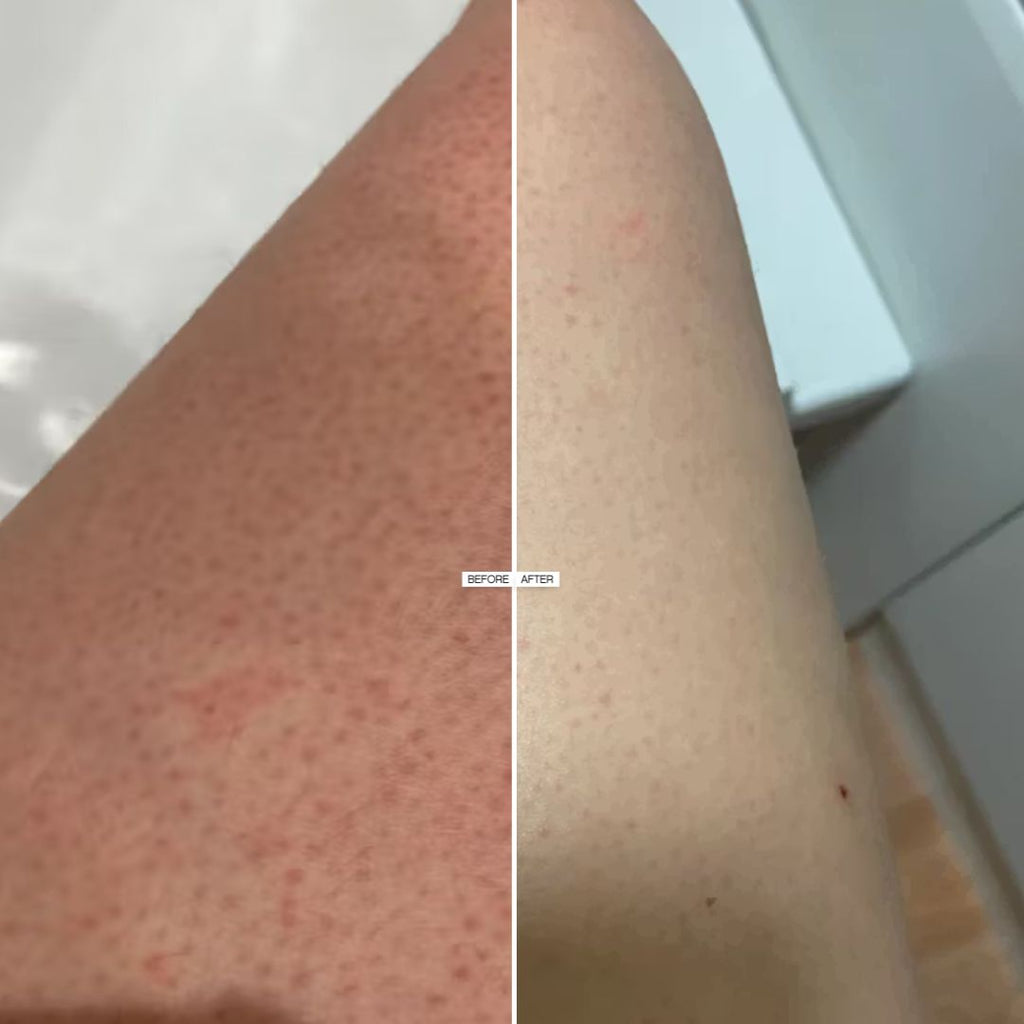 Topicals Slather Exfoliating Body Serum with Retinol and AHAs